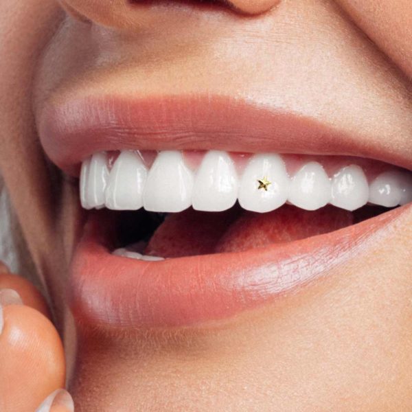 103 Small star tooth gem twinkles dental