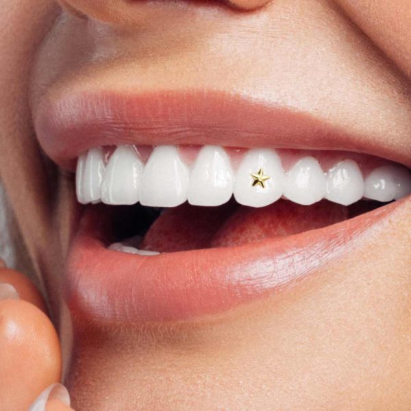 104 Large star tooth gem twinkles dental
