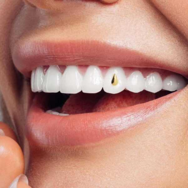 106 Large drop tooth gem twinkles dental