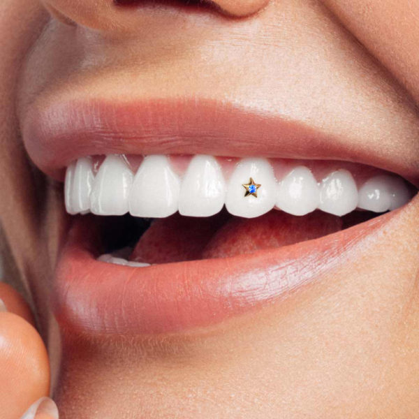129 Start w Diamond tooth gem twinkles dental jewelry in smile 1024x1024 1 1
