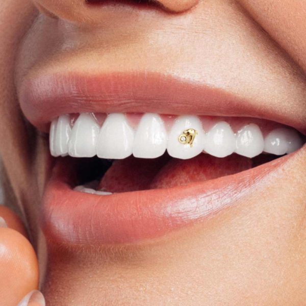 131 Dolphin Diamond tooth gem twinkles dental
