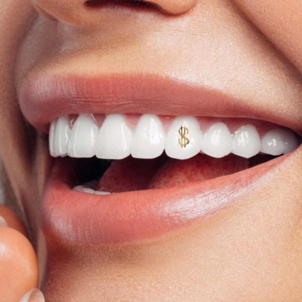139 Dollarsign tooth gem twinkles dental