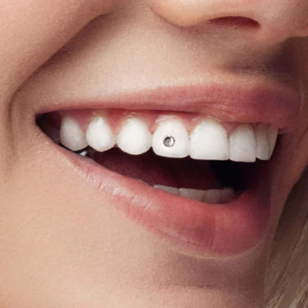500030 9 6 Crystal Clear 2.7mm 6 pack tooth gem twinkles dental jewelry in smile 46dff7d6 a4df 473e a3e4 dd1c762b179a 1